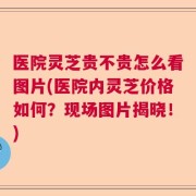 医院灵芝贵不贵怎么看图片(医院内灵芝价格如何？现场图片揭晓！)