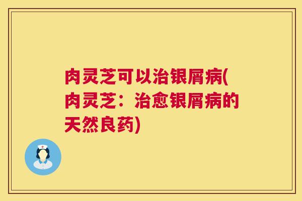肉灵芝可以治银屑病(肉灵芝：治愈银屑病的天然良药)  第1张