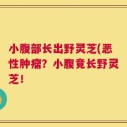 小腹部长出野灵芝(恶性肿瘤？小腹竟长野灵芝！