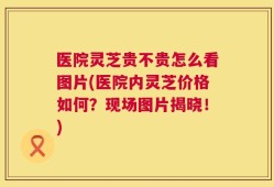医院灵芝贵不贵怎么看图片(医院内灵芝价格如何？现场图片揭晓！)