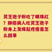 灵芝孢子粉吃了眼珠红？肺癌病人吃灵芝孢子粉身上发痒起疙瘩是怎么回事