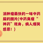 消肿瘤最快的一味中药屎的图片(中药臭瘤“神药”现身，病人爆哭感恩！)