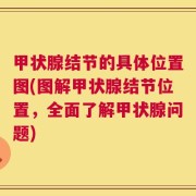 甲状腺结节的具体位置图(图解甲状腺结节位置，全面了解甲状腺问题)