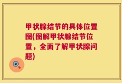 甲状腺结节的具体位置图(图解甲状腺结节位置，全面了解甲状腺问题)