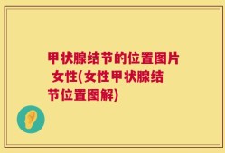 甲状腺结节的位置图片 女性(女性甲状腺结节位置图解)