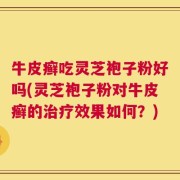 牛皮癣吃灵芝袍子粉好吗(灵芝袍子粉对牛皮癣的治疗效果如何？)