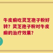 牛皮癣吃灵芝孢子粉好转？灵芝孢子粉对牛皮癣的治疗效果？