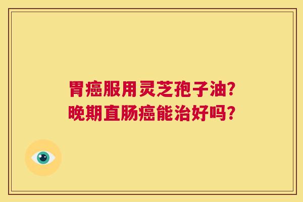 胃癌服用灵芝孢子油?晚期直肠癌能治好吗? 第1张 胃癌服用灵芝孢子油?晚期直肠癌能治好吗? 第1张