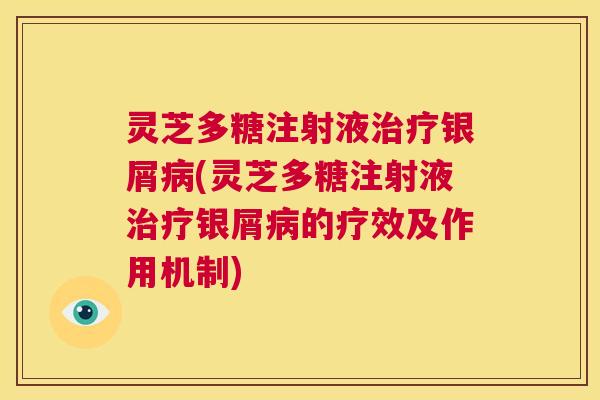 灵芝多糖注射液治疗银屑病(灵芝多糖注射液治疗银屑病的疗效及作用机制) 第1张 灵芝多糖注射液治疗银屑病(灵芝多糖注射液治疗银屑病的疗效及作用机制) 第1张