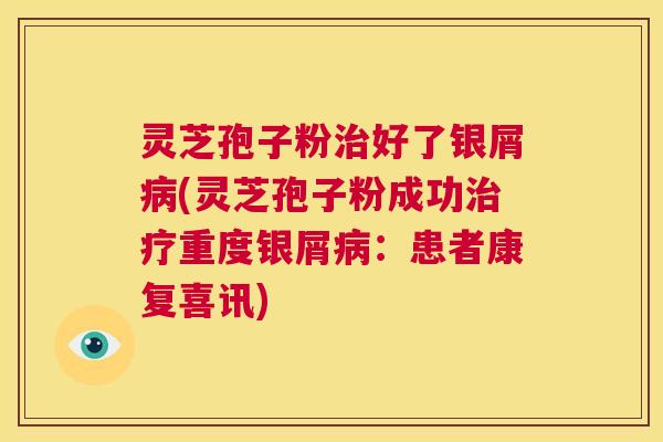 灵芝孢子粉治好了银屑病(灵芝孢子粉成功治疗重度银屑病:患者康复喜讯) 第1张 灵芝孢子粉治好了银屑病(灵芝孢子粉成功治疗重度银屑病:患者康复喜讯) 第1张