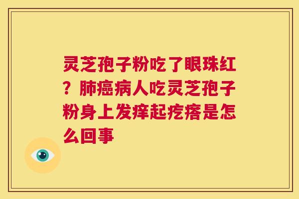 灵芝孢子粉吃了眼珠红?肺癌病人吃灵芝孢子粉身上发痒起疙瘩是怎么回事 第1张 灵芝孢子粉吃了眼珠红?肺癌病人吃灵芝孢子粉身上发痒起疙瘩是怎么回事 第1张