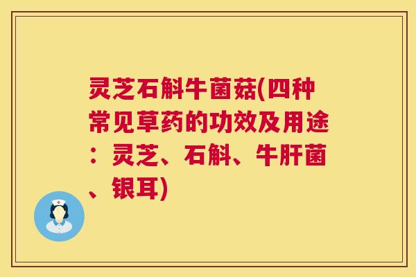 灵芝石斛牛菌菇(四种常见草药的功效及用途:灵芝、石斛、牛肝菌、银耳) 第1张 灵芝石斛牛菌菇(四种常见草药的功效及用途:灵芝、石斛、牛肝菌、银耳) 第1张